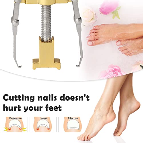 Alati za pedikuru za korekciju za nokte, omekšavanje i jednostavno obrezivanje, profesionalni toenail fiks