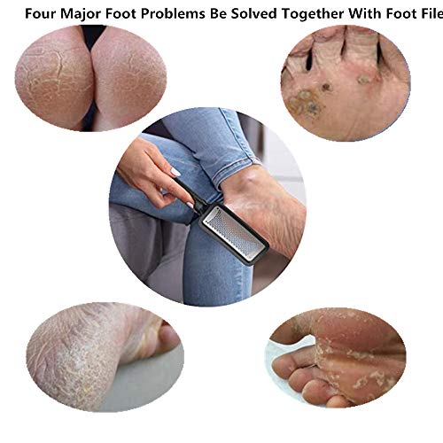 Pedikir Rasp foot Files Callus remover-Aniso najbolja Njega stopala pedikir metalni Površinski alat za uklanjanje tvrde kože, može